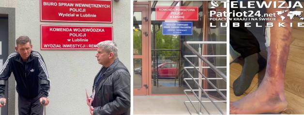 [VIDEO] Patriot24.net ujawnia: Kontrowersyjna interwencja policji w Łęcznej. Obywatel trzeźwy, obrażenia potwierdzone, świadkiem był jego syn